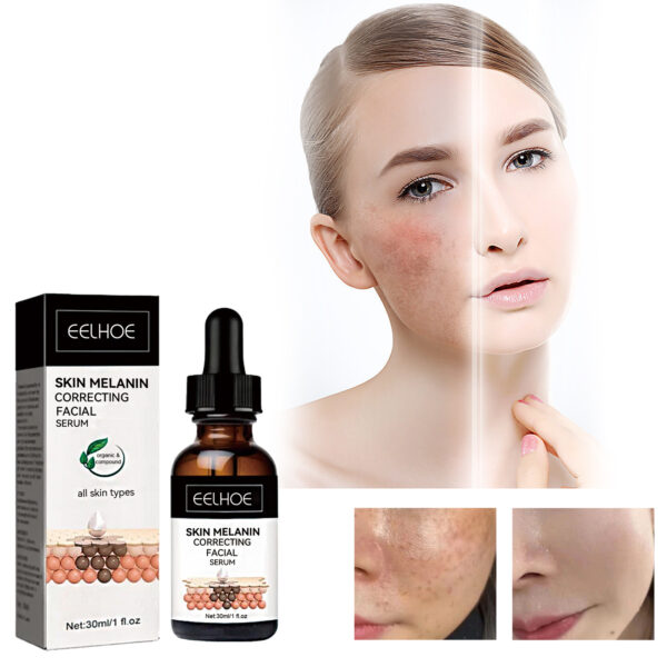 Facial Melanin Repair Hydrating Skincare Products - Image 3