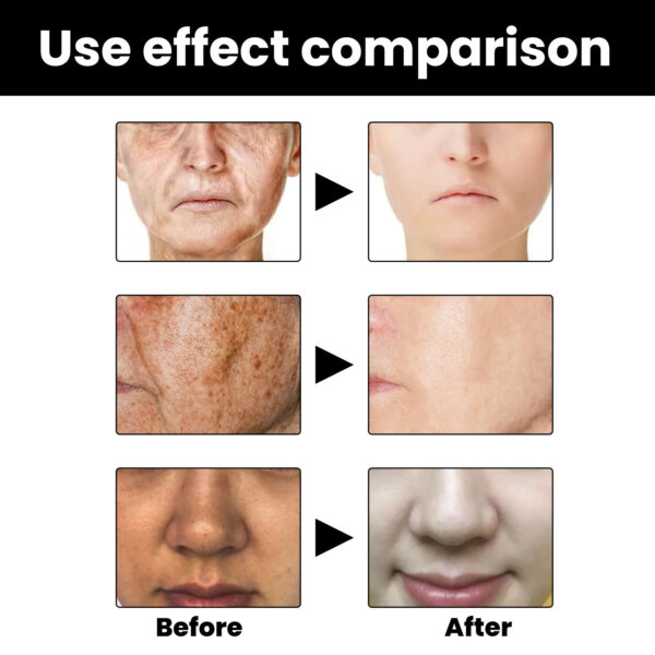 Facial Melanin Repair Hydrating Skincare Products - Image 4