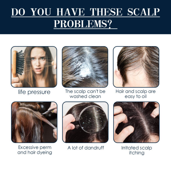 Hair Care Hair Follicle Damage Hair Root Care Spray - Image 5