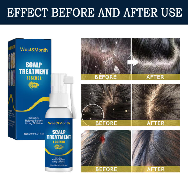 Hair Care Hair Follicle Damage Hair Root Care Spray - Image 4
