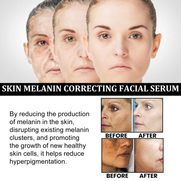 Facial Melanin Repair Hydrating Skincare Products - Image 7