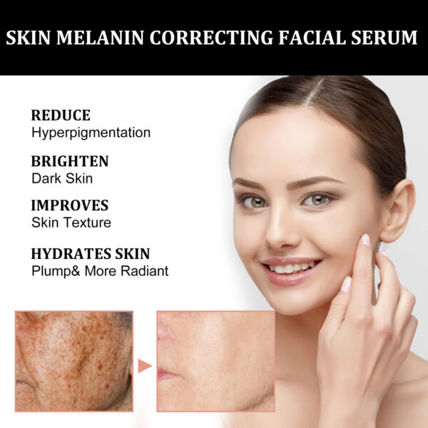 Facial Melanin Repair Hydrating Skincare Products - Image 5